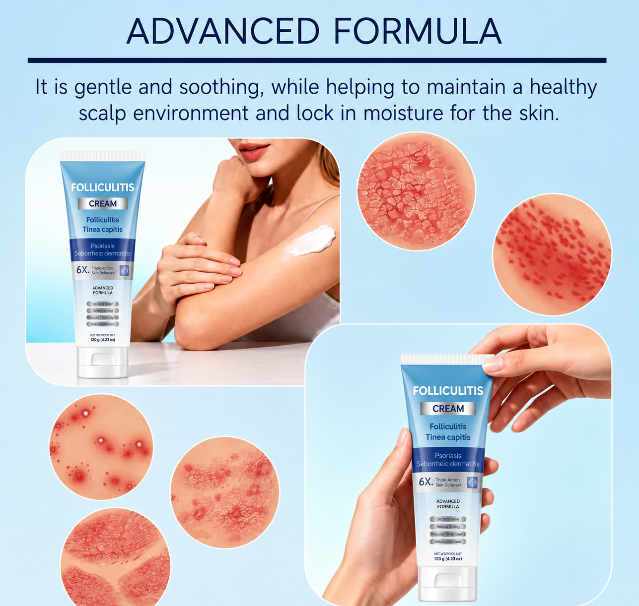 Folliculitis Soothing Cream for Folliculitis Scalp Face and Body✨