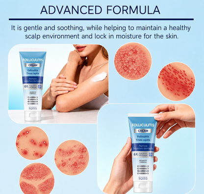 Folliculitis Soothing Cream for Folliculitis Scalp Face and Body✨