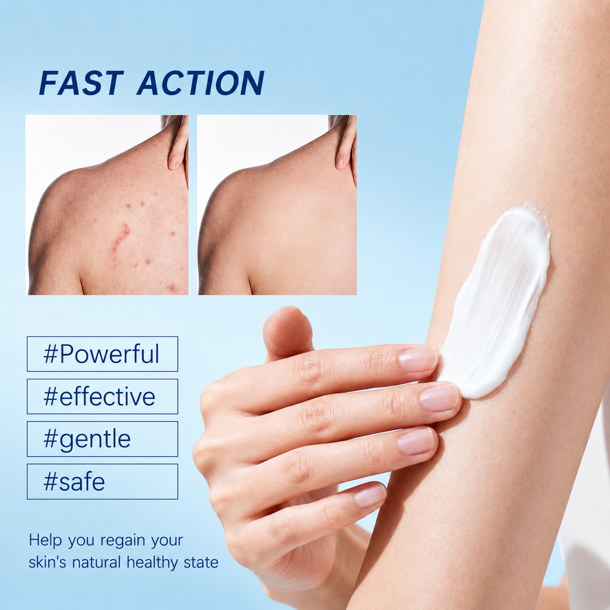 Folliculitis Soothing Cream for Folliculitis Scalp Face and Body✨