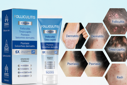 Folliculitis Soothing Cream for Folliculitis Scalp Face and Body✨