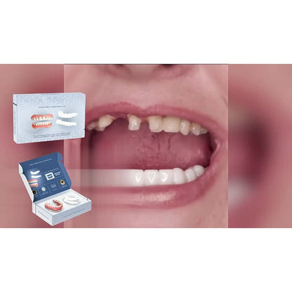Instant Custom-Fit Home Dentures