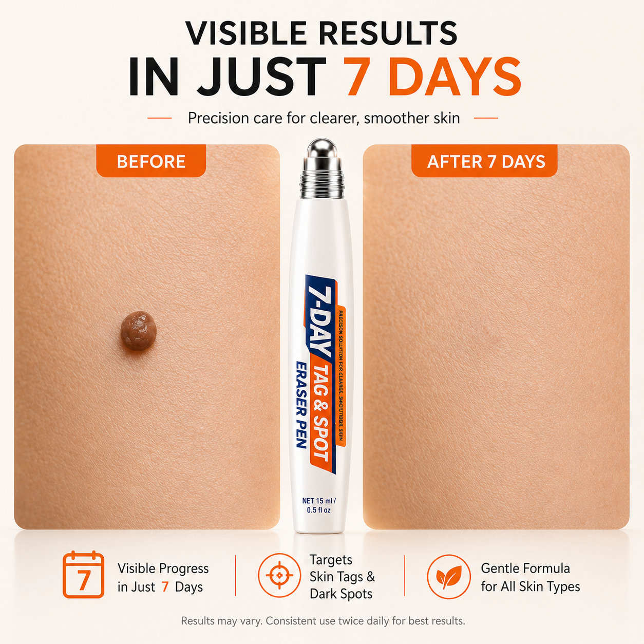 7-Day Skin Tag & Spot Precision Rollerball Pen
